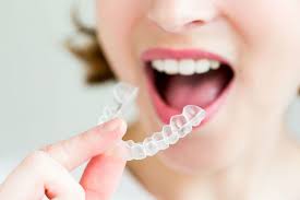 Invisalign Braces